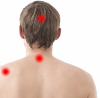 Ohnisko osteochondrosy