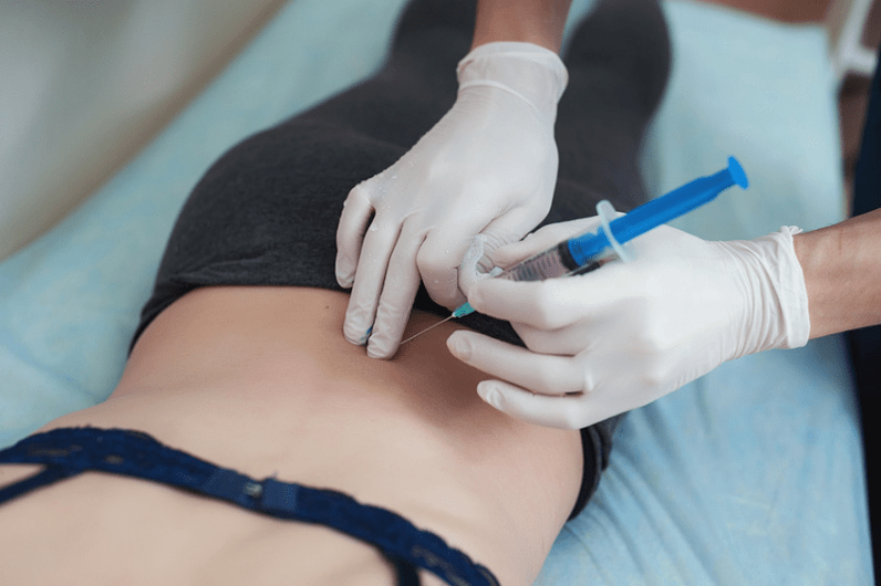 blokáda u bederní osteochondrózy